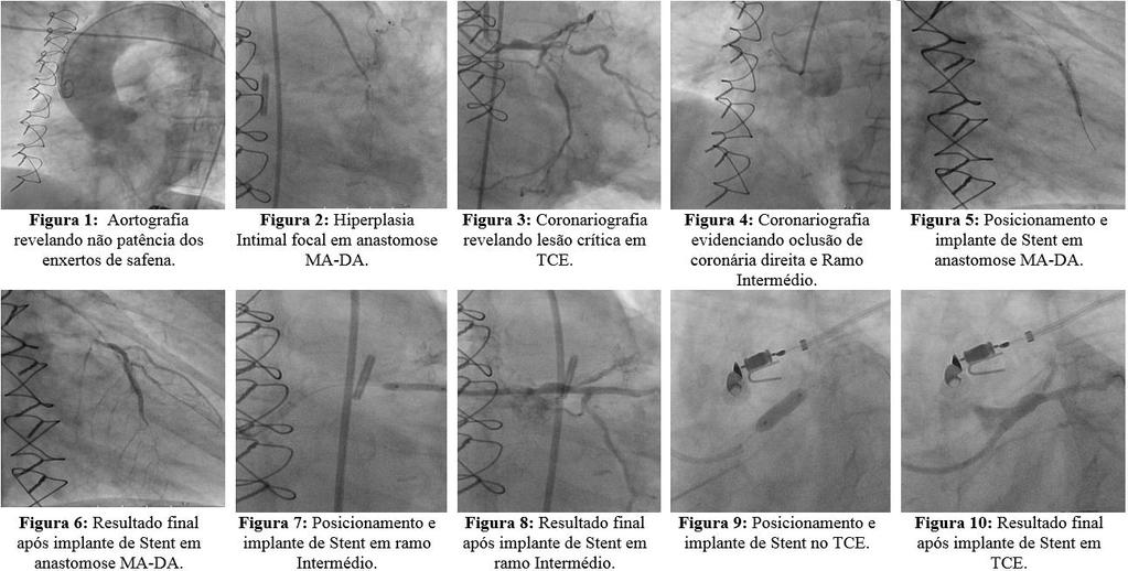 Acta Biomedica Brasiliensia / Volume 8/ nº 1/ Julho