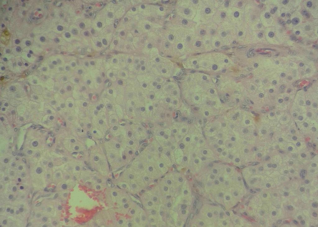 A B FIGURA 3: Fotomicrografia de fragmento de neoplasia testicular de cão. Seminoma. (A) células neoplásicas, arranjadas em manto, intra e extratubulares. HE. Aumento 10x.