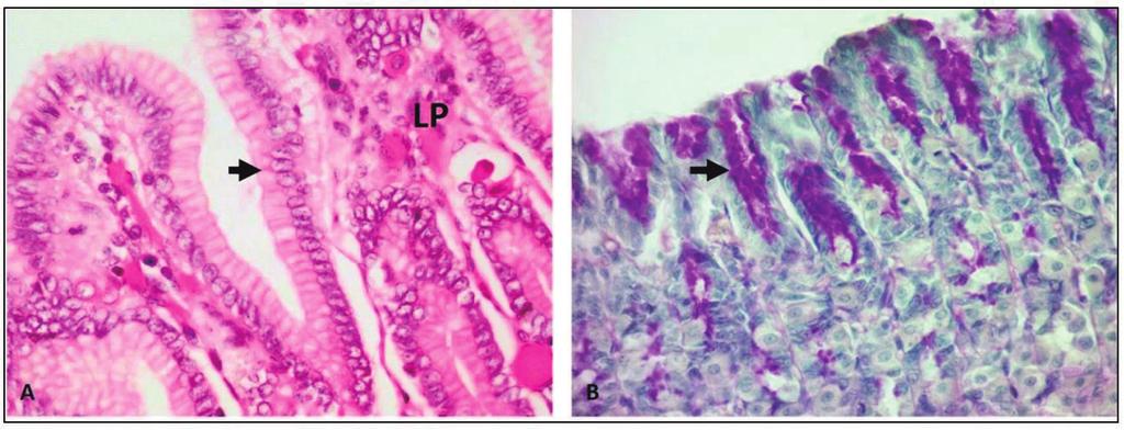 Reinaldo Barreto Oriá 285 Figura 12.9 Microfotografias da túnica mucosa do estômago. A. As células epiteliais produtoras de muco da cripta/ fosseta (seta) são contínuas com o epitélio de revestimento.