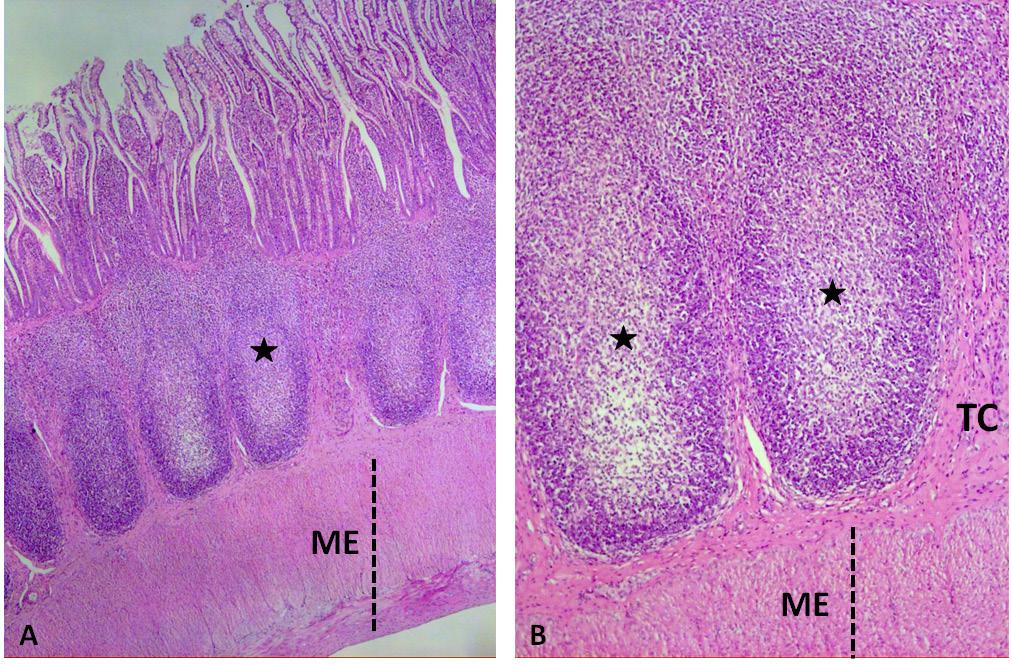 306 Sistema digestório: integração básico-clínica Figura 12.24 Placa de Peyer no íleo. A. Nódulos linfoides (asterisco) na submucosa. Coloração HE. Aumento X100. B.