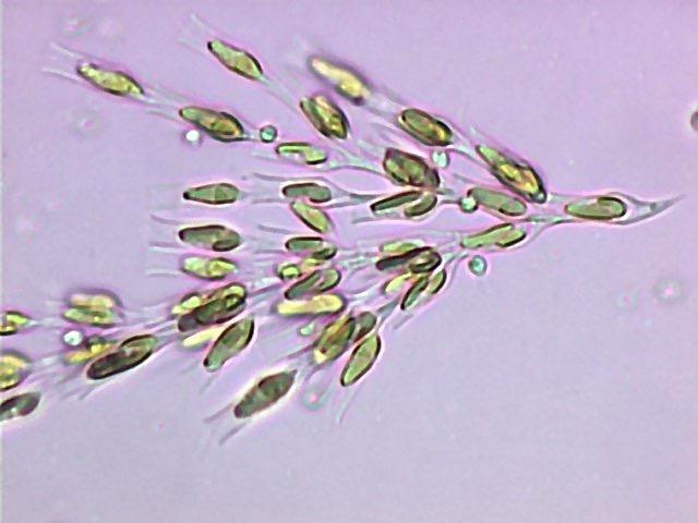 CHRYSOPHYTA Crisofíceas ou Diatomáceas - algas douradas Diatomáceas apresentam aspecto rígido por sua carapaça composta por sílica Unicelulares de água doce ou