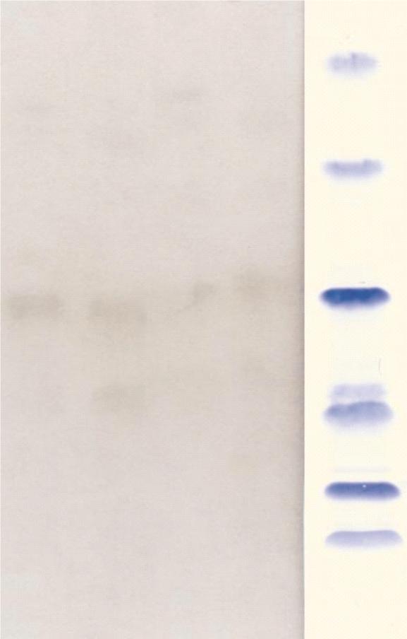 ANAFILAXIA À FAVA / CASO CLÍNICO Figura 1. SDS-PAGE Immunoblotting para a fava. D: soro da doente. C: soro controlo negativo. M: padrão de massas moleculares. (-): sem mercaptoetanol.