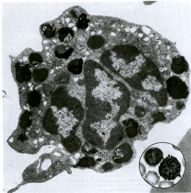 Basófilo humano, eletromicrografia Citoplasma com grânulos 1ários, azurófilos, lisossomos Ocorrem em todos os leucócitos Contêm enzimas: hidrolases ácidas Núcleo lobulado Heterocromatina na periferia