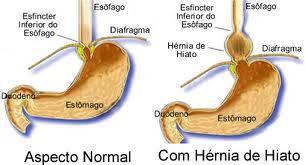 permanecerem nele por algum tempo,