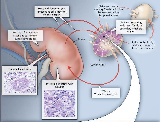 Interação APC linfócito T APCs do doador ou do receptor migram para os órgãos linfóides secundários (T-cell areas).