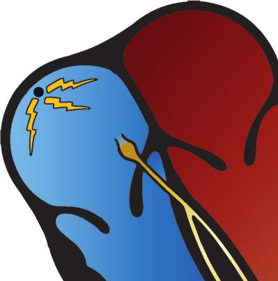 14 Malcolm S. Thaler C 0 mv 90 mv A B D O ciclo elétrico de despolarização-repolarização de uma célula de marca-passo cardíaco. O ponto A é o potencial negativo mínimo.