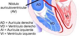 Complexo QRS: despolarização ventricular