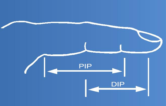 A força aplicada sobre a articulação é cerca de 3,4 N em 15º de flexão. INDICAÇÕES Contraturas de flexão com limitações no âmbito do movimento e rigidez crescente das articulações.