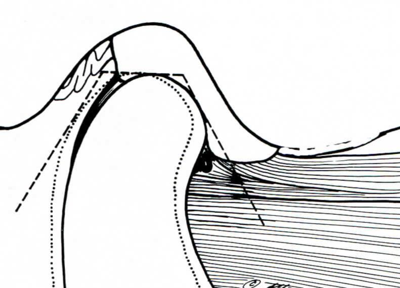 ANEXOS Anexo 1 D E C Anexo 1 adaptado de Okeson, 2000 Posição em Relação Cêntrica C- Côndilo da mandíbula; D- Disco articular; E- Eminência articular A relação cêntrica é uma posição