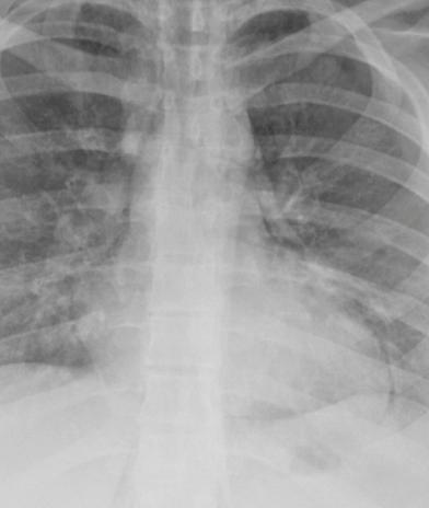 Disciplina de Radiologia Torácica e Cardiovascular - Faculdade de Medicina de