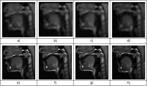 Segmentação Análise do tracto vocal durante a fala partir de imagens de ressonância magnética: modelos activos de aparência Segmentação inicial Segmentações intermédias Segmentações intermédias