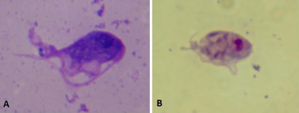principalmente quando coparasitados (Monteiro, 2014). Os parabasalídeos são organismos pertencentes ao filo Parabasalia (Figura 2).