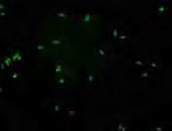 129 A B C Figura 15- Fotomicrografia de epifluorescência das células espermáticas coradas com Acridine Orange (A O). A.e B. Espermatozóides normais com cromatina íntegra (fluorescência verde). C. Espermatozóide anormal com cromatina lesada (cor vermelha).