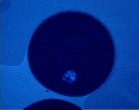 24 A B 1º CP Figura 1 - Fotomicrografia das diversas fases da maturação nuclear de oócitos bovinos observados sob microscópio de epifluorescência A) Oócitos em VG: cromossomos descondensados; B)