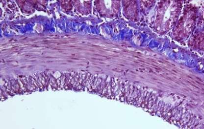 16 Submucosa Muscular circular interna Muscular longitudinal externa Fig. 1 Fotomicrografia de íleo de rato saudável com a coloração tricrômico de Masson (400X).