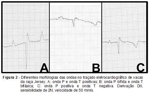 22 Parâmetros eletrocardiográficos de novilhas da raça Jersey No segmento ST não ocorreram os fenômenos de infradesnivelamento ou supradesnivelamento, semelhantemente encontrado por Oliveira et al.