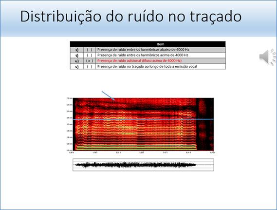 518 Lopes LW, Alves GÂS, Melo ML Distribuição do ruído no traçado Figura 4.