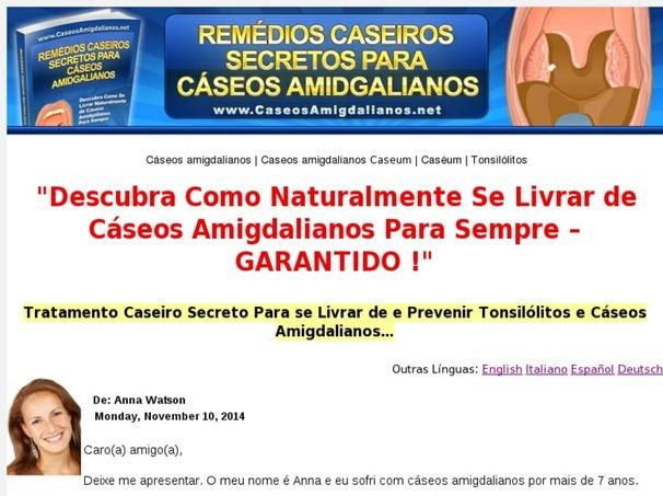 Additional information >>> HERE <<< Remédios Para Cáseos / Caseums Amigdalianos - Detailed Info Remédios para cáseos / caseums amigdalianos - detailed info Full page here --> http://urlzz.