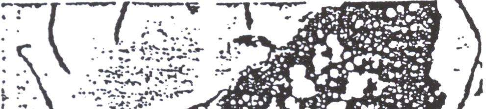 Figura 11 Imagem de composição em exame por microssonda de drosses em