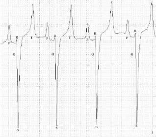 Parâmetros eletrocardiográficos de equinos Puro Sangue Árabe submetidos a exercício prolongado de enduro.