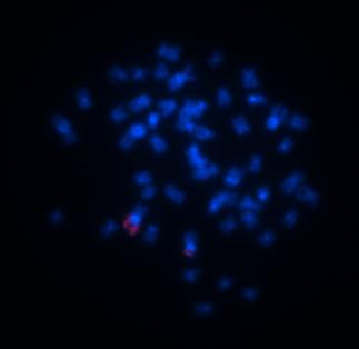 FIGURA 4: FISH (Hibridização in situ fluorescente) com