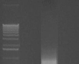 Cowpea severe mosaic virus (CPSMV) sorotipo I L 1 2 3 575 pb Eletroforese em