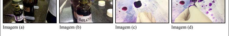 demonstrado na Figura 2, primeiramente foram separados os materiais para coloração sendo eles: Cristal