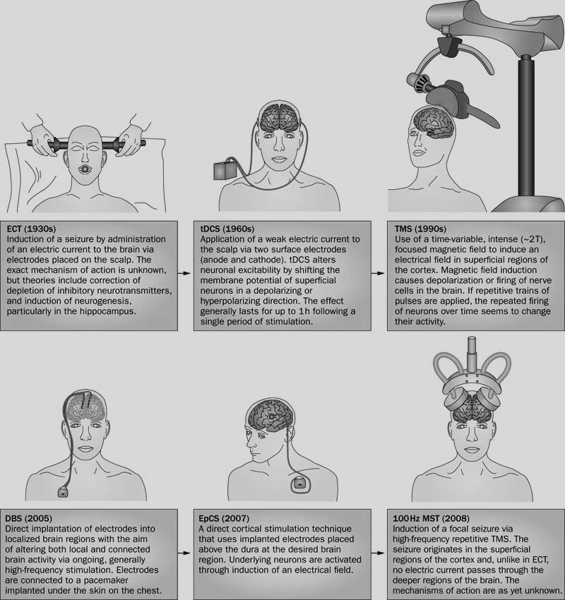 (2010) Brain stimulation in