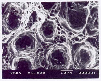 microcavidades refinadas e deformadas plasticamente se apresentando na forma de alvéolos (dimples).