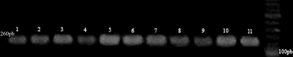 Amplification of DNA from buffalo fur in each region for each protocol.