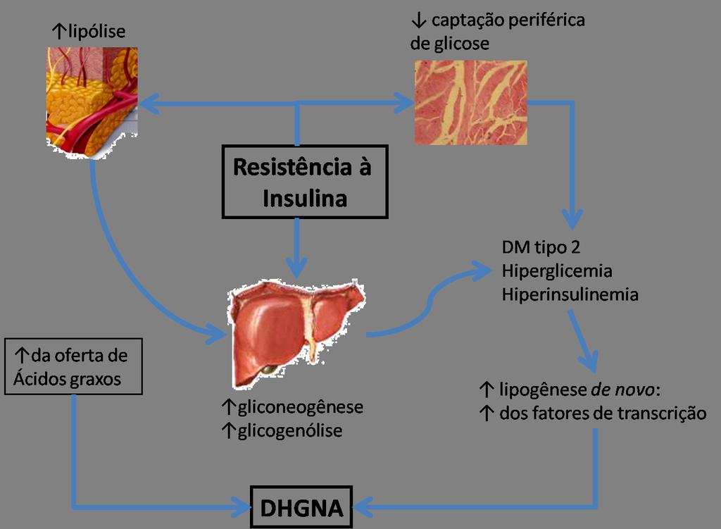 O papel da Resistência à insulina na