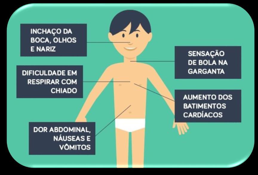 Anafilaxia Anafilaxia é uma reação alérgica sistémica, severa e rápida, a uma determinada substância, chamada alergénico ou alérgeno, caracterizada pela diminuição da pressão arterial, taquicardia e