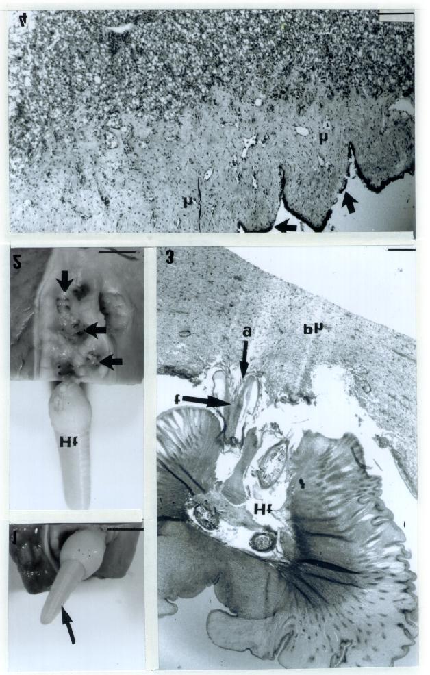 171 Histopatologia no fígado de Prionace glauca... Figs. 1-4: 1. Pós-larva de Hepatoxylon trichiuri (seta) fixada ao fígado através dos tentáculos. Barra: 0,5 cm. 2.