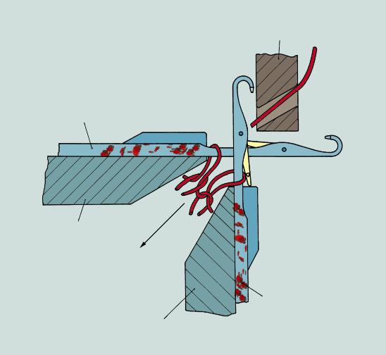 Agulha do disco Posição do tear de malha Guia-fio Ao trabalhar fios, sobretudo artificiais, é freqüente acumularem-se nos meandros do corpo e nos canais da agulha partículas de sujidade, pó e lanugem