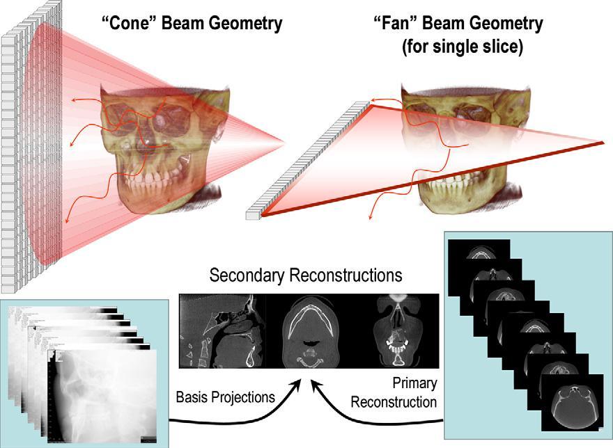 são aplicados a estes dados de imagem para gerar um conjunto de dados 3D volumétricos, que podem ser usados para fornecer imagens de reconstrução primária em planos ortogonais (axial, sagital e