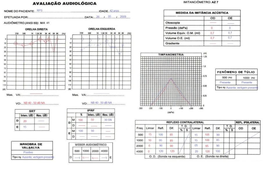 122 Godoy CCF, Ávila KCEW, Andrade AN, Gil D irradiação frontal, pulsátil com naúseas, aversão ao som e luz.