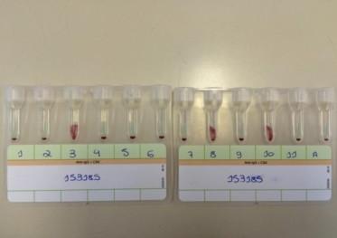 Pipetar 50 ul de cada hemácia teste do Painel nos microtubos correspondentes numerados de 1 a 11. 4. Adicionar 25 ul de soro ou plasma do paciente nos 11 microtubos. 5. Incubar o Cartão por 15 minutos à 37 graus Celsius em incubadora.