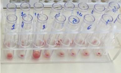 Adicionar no tubo 50 ul de concentrado de hemácias e 50 ul de soro/plasma do paciente e homogeneizar bem. 3.