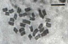 400 DAVIDE, L. C. et al. A B C D FIGURA1 Metáfases mitóticas. A. BAG 27; B. BAG 45; C. BAG 46 e D. BAG 103 (P. purpureum 2n=28 cromossomos). As barras representam 5 m. FIGURA 1 - Metáfases mitóticas.