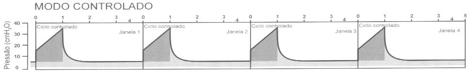 Classificação dos Modos Ventilatórios