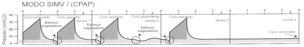 Classificação dos Modos Ventilatórios Ventilação mandatória