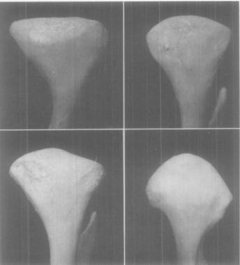 29 da mandíbula (Figura 4, 5 e 6).