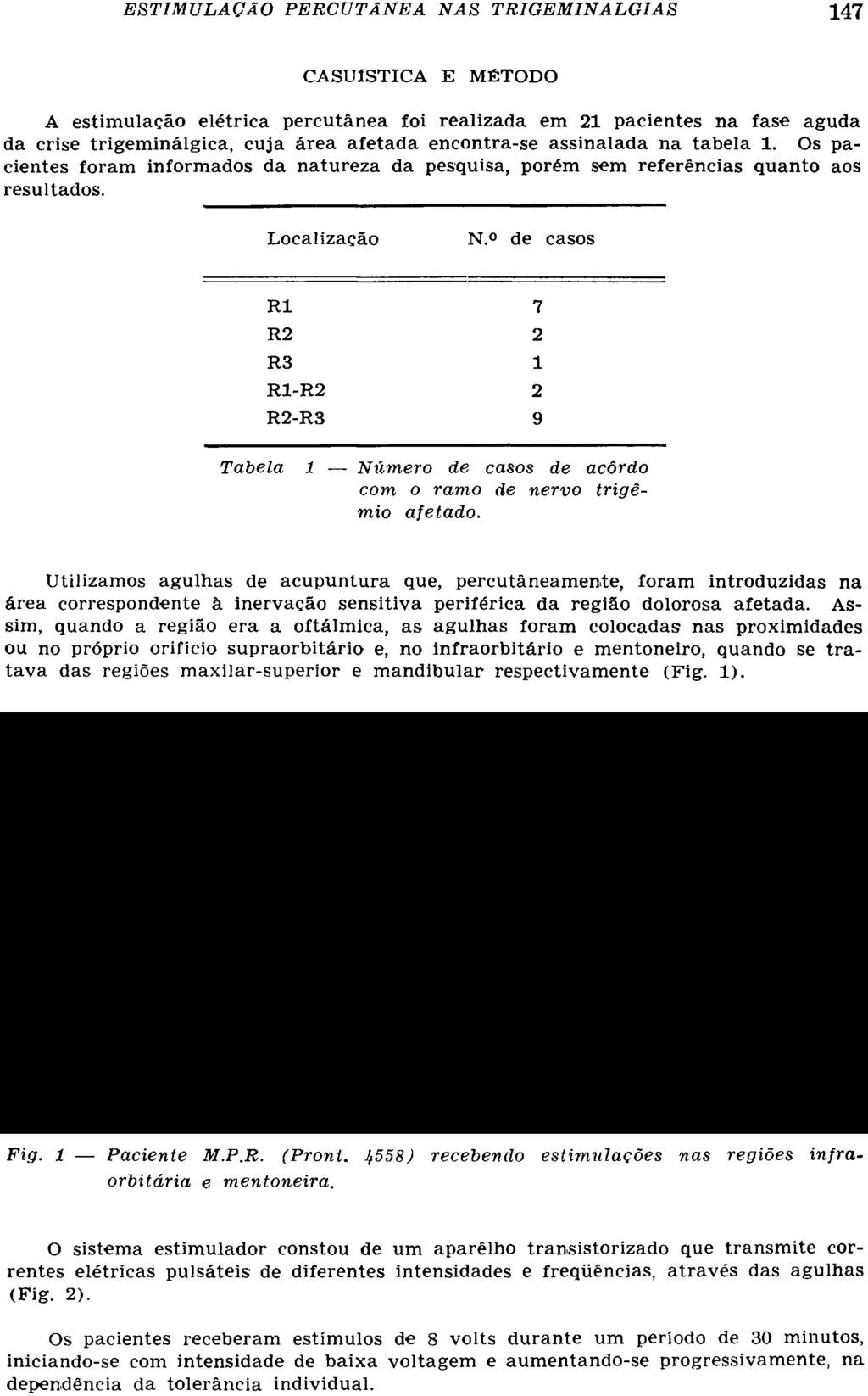 CASUÍSTICA E MÉTODO A estimulação elétrica percutânea foi realizada em 21 pacientes na fase aguda da crise trigeminálgica, cuja área afetada encontra-se assinalada na tabela 1.