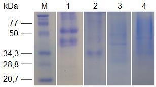 32 Figura 2 Análise da pureza e aparente peso molecular das proteínas por SDS-PAGE. Todas as proteínas purificadas foram submetidas à SDS-PAGE 12% e coradas com coomasie blue.