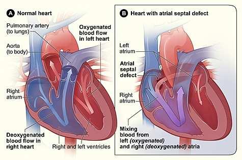 Cardiopatias congênitas e malformações extracardíacas Rev. paul. pediatr. vol.31 no.
