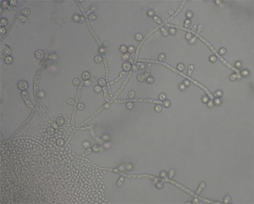 de 20X e 40X para observação das características micromorfológicas do fungo (SIDRIM & ROCHA, 2004). Figura 2 Micromorfologia de C.