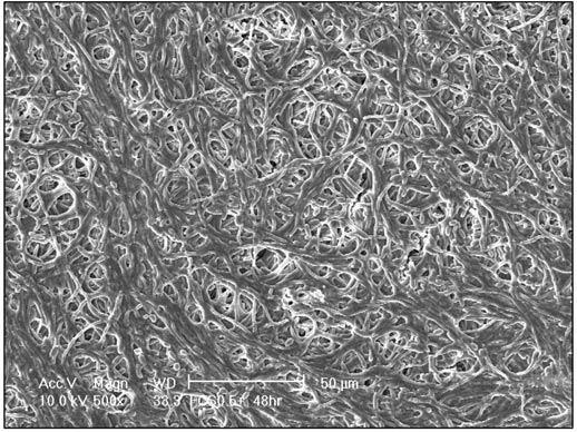 2.13 - Biofilme e Antifúngicos Um biofilme é uma comunidade microbiana estruturada de células delimitadas em uma matriz de substâncias poliméricas extracelulares (EPS), irreversivelmente ligado a um