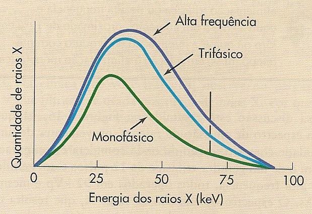 Parâmetros de técnica radiográfica kvp Alta tensão, forma de onda e energia A intensidade dos raios X e sua