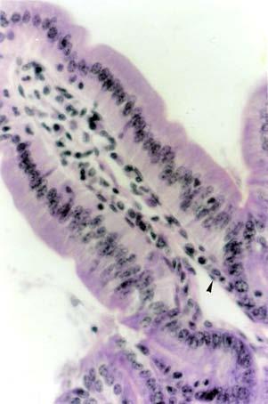 M T. Montanari, UFRGS O epitélio é simples colunar com microvilos e células caliciformes. Há ainda as células enteroendócrinas, as células de Paneth e as células-tronco.