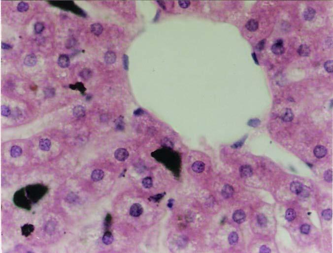 G. da C. da Silva, T. de O. Plá & T. Montanari, UFRGS Figura 8.31 - Capilares sinusoides entre as placas de hepatócitos desembocando na vênula hepática terminal (ou centrolobular). HE.